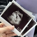 참조은안과의원 이미지