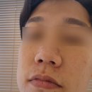 제노사이언스 | 세종피부관리 셀로에스테틱 맞춤형 관리로 효과 좋았던 곳