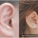 오티콘보청기도봉점 이미지