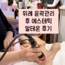 KSNET_N와이즈케어 | 위례피부관리 [후에스테틱] 알테온 리프팅관리 찐만족후기