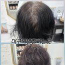 김호증모가발대구체인헤어슈 | 대구가발 잘하는곳 헤어38년 경력 명장이 만든 맞춤가발