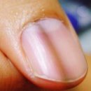 손톱 - 거제시 | 손톱