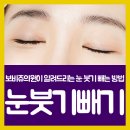 보비쥬의원 이미지