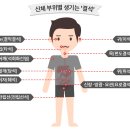 몸에 돌이 자란다 이미지