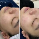 시엘 메디칼 | [대전피부관리] 모공, 여드름 고민은 원신흥동 "프리시엘스킨"