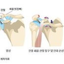 쇄골 통증 원인 및 치료 : 왼쪽 오른쪽 이미지