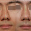 얼핏한의원 이미지