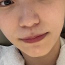 아쿠아커피연구소 | 금천구 피부관리/가산동 피부관리]다드림피부연구소 가산점 아쿠아필링 후기(파메스테틱, 파메니악 인증샵)