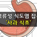 역류성 식도염 잡는 사과 식초 이미지