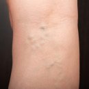 근육본부 이미지