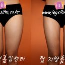 탑바디클리닉 이미지
