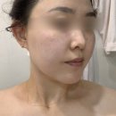인천 용현동 피부관리 블랙헤드 모공관리 잘하는 곳 사랑에빠진피부 솔직 후 기