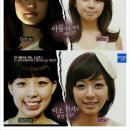 렛미인 이미지