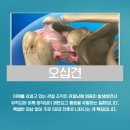 소사한의원 | 소사구한의원, 오십견 침치료 정말 효과있을까