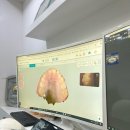 이바른치과교정과치과의원 | 초등학생 교정치과 상담 후기 이대더바른이치과교정과치과의원