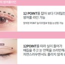 팝성형외과의원 | 서울시 강남구 성형외과 소개 .. 팝 성형외과의원