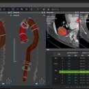 라인소프트 이미지