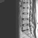 기대된다. neuropathic pain환자의 치료! 이미지