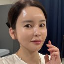 슈's | 홈키트 초특가 가격 할인 셀프모공주사 롤링 MTS 사용법 부작용 주기 효과 5회 홈슈젝 홈케어 후기