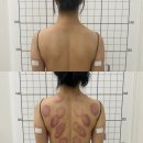 두현과학 | 김포 피부관리/체형관리 뷰티온 다녀온 솔직 후기