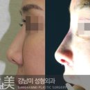 강남미의원 이미지