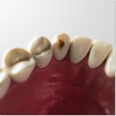 미소가밝은치과의원 이미지