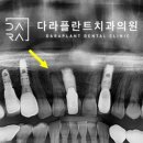 본레져 이미지