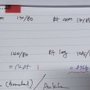 초이스의원 | 리바운드 고혈당 현상 - 혈관 좁아짐, 말초동맥질환 PAD 증상이 맞았다.