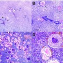 귀족도미의 Lactococcus garviae 이미지
