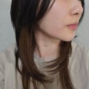 원더핏 | 강남역 얼굴 지방분해주사 원더핏주사 이중턱 심부볼 후기