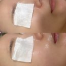 윤정분 스킨케어 | 가산 독산 피부 재생 여드름 관리 윤정분 스킨케어 방문
