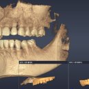 나노치과기공소 이미지