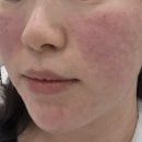 유앤아이의원 | 처진 이중턱 안녕! 유앤아이 의원 내돈내산 리뷰