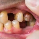 고려대학교 임상치의학대학원 이미지