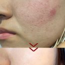 리코스메틱 | 더마 코스메틱 추천템 장벽부문 1위 피부장벽크림 후기