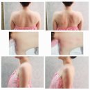 뷰티 앤 슬림 | 울산 신부관리 뷰티앤슬림 웨딩관리 라인 윤곽 피부관리 후기