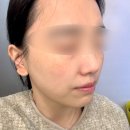 라벨르 스킨앤바디 | 대전피부관리 라벨르스킨앤바디에서 물광 피부 된 후기