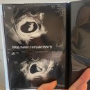 위드곰 | 울산 위드여성병원 8주1일차 임신 초기 난소물혹