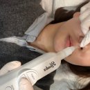 자연행복한의원 | 강남입꼬리비대칭교정 한의원 8회차 차이점 비교하는 후기