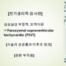 PSVT (상심실성 부정맥. 빈맥) 의 시술적 치료 / 전극도자 절제술_사랑의 심장내 이미지