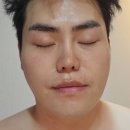 정안약국 | 대구시지피부과, 피부고민 5초만에 해결하는 리팟레이저 후기