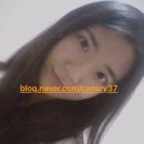 43 앞 ~ 15 앞 | 다크서클! 강남역 피부과에서 울트라콜 + 앞광대 필러 내돈내산 후기, 필러 녹이기