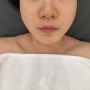 청라 피부관리 로로에스테틱 맞춤관리 솔직후기