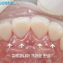 신세계치과기공소 이미지