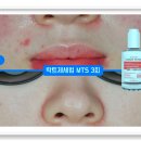 빛채은에스테틱 대구진천점