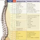 척추 전방전위증 관리 예방법 이미지