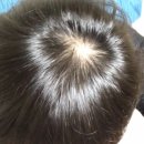 (주)서로돕는사람들 | 프로페시아 효과