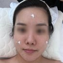 두물로 11 | 별내 피부관리 온날뷰티 압출 잘 하는 곳 여드름관리 후기