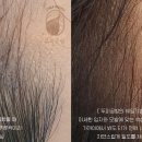 두피공방헤어라인