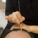 두피 탈모 아미치 0.3 수원점 이미지